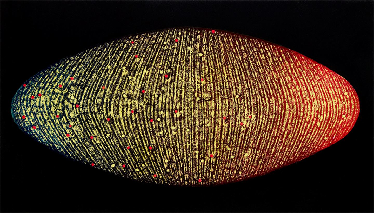 foto av kunstverk som heng på tannhelseklinikken i Åsane